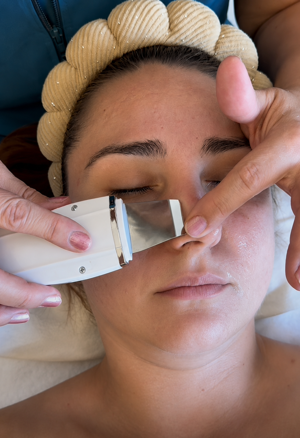 Limpieza Facial Profesional